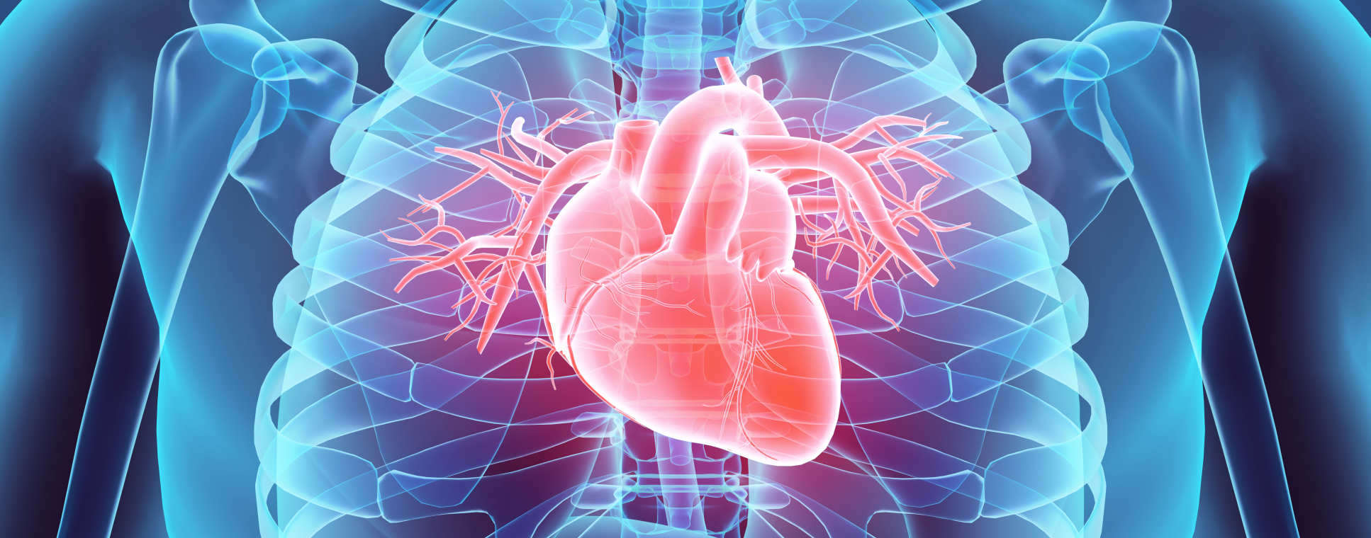 cvd